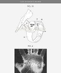 Apple wins a patent for palm ID biometric authentication that could be used on future iDevices