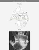 Apple wins a patent for palm ID biometric authentication that could be used on future iDevices