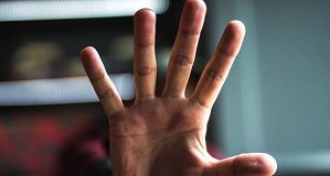 Swiss Researchers Hunt For Contactless Palm Vein Biometric Scanners For Hospitals